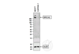 anti-Breast Cancer 2, Early Onset (BRCA2) (AA 21-130) antibody