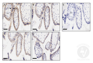 Staining  with ABIN761396 at dilutions 1:200, 1:250, 1:300, and 1:400 (A, B, C, and D) using a 7 week elective termination of a pregnancy that tested negative for trisomies (Clark et al. (2017) Am. J. Reprod. Immunol). Optimal staining was obtained at 1:200 dilution. Anti-KLH control (E) at 1:200 was negative. 