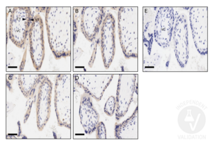 CD200 anticorps  (AA 41-140)