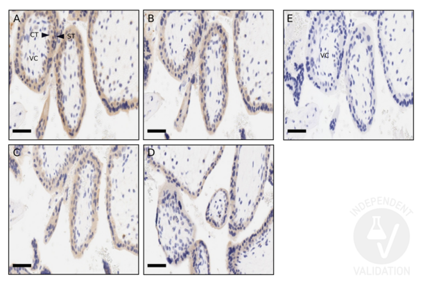 CD200 anticorps  (AA 41-140)