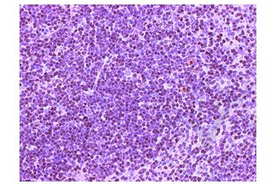 Immunohistochemistry validation image for anti-CD4 (CD4) (AA 385-457) antibody (ABIN671376)