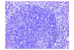 Immunohistochemistry validation image for anti-CD4 (CD4) (AA 385-457) antibody (ABIN671376)