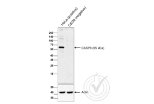 Figure 1: Western blot of lysates from HeLa cells (Lane 1), and c6/36 cells (Lane 2) probed with anti-CASP8 (upper panel) or with anti-Actin for loading control (lower panel). 