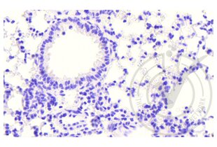 Immunohistochemistry validation image for anti-Coagulation Factor III (thromboplastin, Tissue Factor) (F3) (AA 32-100) antibody (ABIN708086)