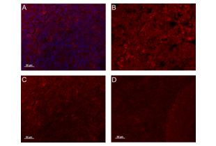 IF validation of CYR61 antibody ABIN674499 on mouse brain tumor sections. A. ABIN674499 diluted 1:100 (red), DAPI counterstaining (blue). B. Dilution factor 1:50. C. Dilution factor 1:100. D. Dilution factor 1:200.