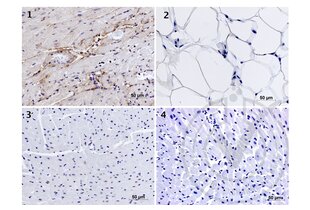 Figure 1: Immunostaining of Elastin antibody. Panel 1: Staining of mouse heart tissue stained with anti-Elastin antibody (brown). Panel 2: Staining of mouse adipose tissue with anti-Elastin antibody. Panel 3: Staining of mouse heart tissue with isotype control antibody. Panel 4: Staining of mouse heart tissue with secondary antibody only. All panels are counterstained with hematoxylin (blue). 