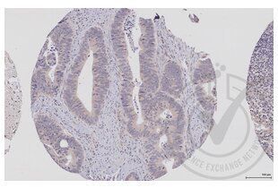 Immunohistochemistry validation image for anti-Eukaryotic Translation Initiation Factor 4E (EIF4E) (AA 121-217) antibody (ABIN1386772)