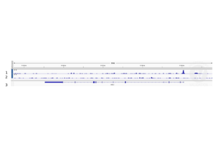 Cleavage Under Targets and Release Using Nuclease validation image for anti-Forkhead Box O1 (FOXO1) (AA 165-270) antibody (ABIN1387620)
