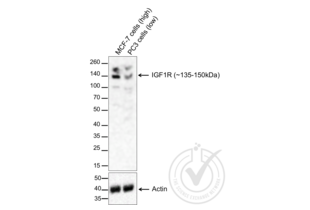 Figure 1. Western blot of lysates from MCF7 cells (Lane 1) and PC-3 cells (Lane 2) probed with anti-IGF1R (upper panel) or with anti-Actin for loading control (lower panel).