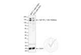 anti-Insulin-Like Growth Factor 1 Receptor (IGF1R) (AA 251-350) antibody