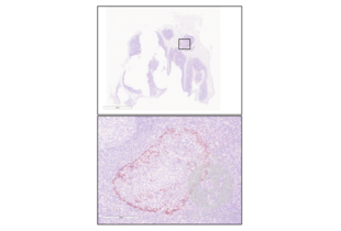 Immunohistochemistry validation image for anti-Interleukin 2 Receptor, alpha (IL2RA) (AA 201-268) antibody (ABIN670371)