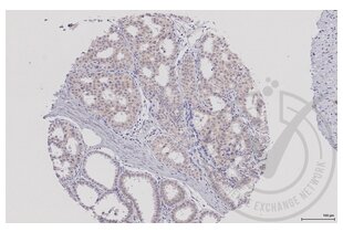 Figure 1: Human breast tissue stained with anti-MAP2K5 (brown) and counterstained with hematoxylin. 
