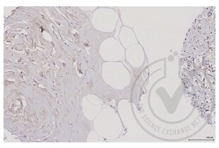 Figure 2: Human breast adipose tissue stained with anti-MAP2K5 (brown) and counterstained with hematoxylin. 
