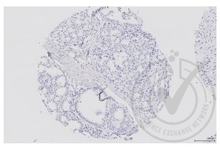 Figure 3: Human breast tissue stained with isotype control antibody (brown) and counterstained with hematoxylin. 