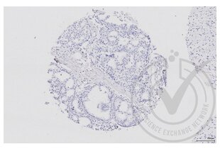 Figure 4: Human breast tissue stained with secondary antibody only (brown) and counterstained with hematoxylin. 
