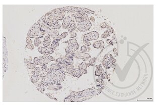 MAPK14 anticorps  (pThr180, pTyr182)