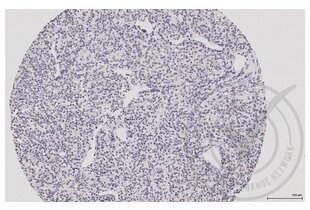 Immunohistochemistry validation image for anti-Mitogen-Activated Protein Kinase 14 (MAPK14) (pThr180), (pTyr182) antibody (ABIN678668)