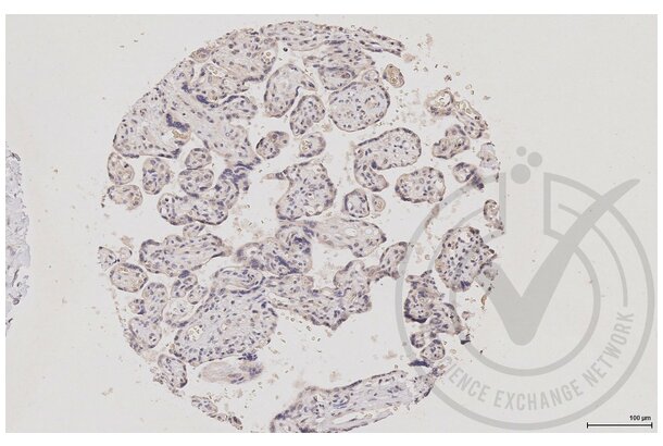 MAPK14 anticorps  (pThr180, pTyr182)