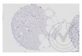 anti-Mitogen-Activated Protein Kinase Kinase 1 (MAP2K1) (AA 2-150) antibody