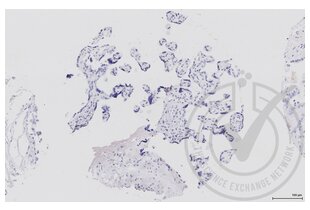 Immunohistochemistry validation image for anti-Mitogen-Activated Protein Kinase Kinase 1 (MAP2K1) (AA 2-150) antibody (ABIN686482)