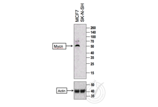 Figure 1: Western Blot for MYCN. Arrowhead indicates the expected molecular weight of ~49 kDa.