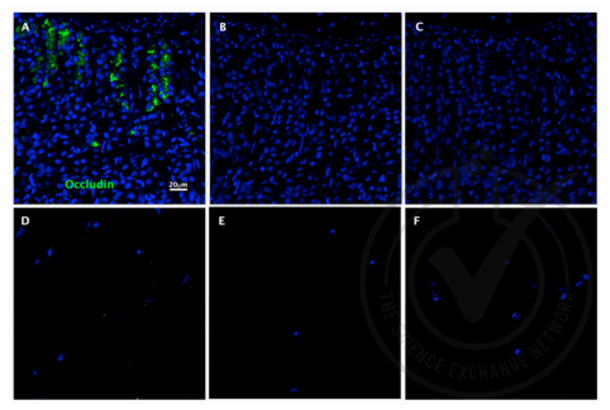 Occludin antibody  (AA 431-522)