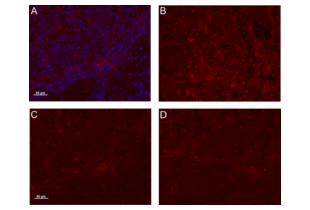 Osteoactivin antibody  (AA 81-180)