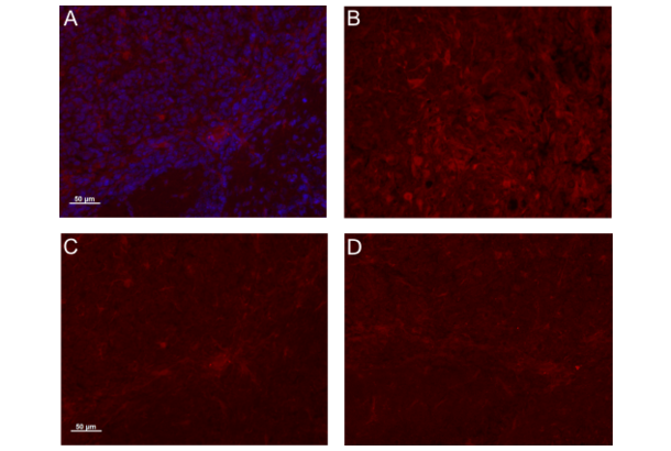 Osteoactivin antibody  (AA 81-180)