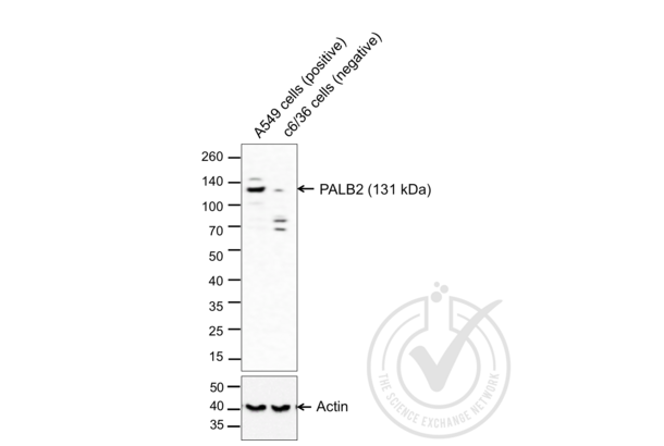 PALB2 抗体  (AA 1101-1186)
