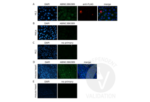 A. IF staining of  cells expressing PKP2-FLAG using ABIN1386389 (green) or an anti-FLAG-tag antibody (red). Nuclear staining with DAPI (blue) (magnification 60x). B. Staining of HeLa cells not expressing PKP2-FLAG using ABIN1386389 (magnification 40x). C. Staining of  cells expressing PKP2-Flag with a secondary antibody only (magnification 40x). D and  E. Staining of endogenous Pkp2 in mouse heart tissue with ABIN1386389 (D) or secondary antibody only (E) (magnification 40x). 
