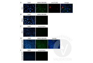 Plakophilin 2 anticorps  (AA 801-881)