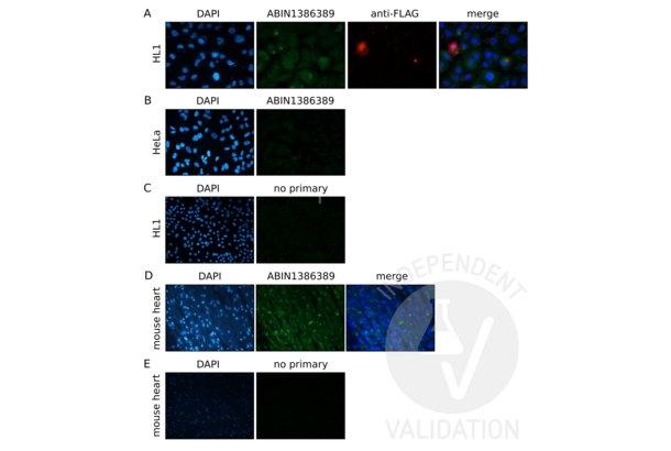 Plakophilin 2 anticorps  (AA 801-881)