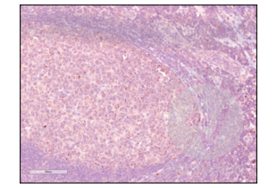 Immunohistochemistry validation image for anti-Programmed Cell Death 1 (PDCD1) (AA 201-288) antibody (ABIN735608) (PD-1 antibody  (AA 201-288))