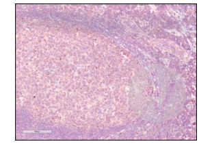 Immunohistochemistry validation image for anti-Programmed Cell Death 1 (PDCD1) (AA 201-288) antibody (ABIN735608)