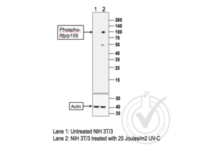 Western Blotting validation image for anti-Retinoblastoma 1 (RB1) (pSer780) antibody (ABIN675294)