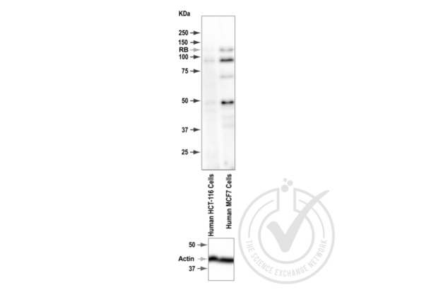 Retinoblastoma 1 抗体  (pSer795)