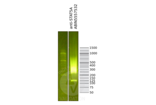 Library profiles comparing fragment size distributions on an E-Gel EX 2% agarose gel (Thermo Fisher). Fragments obtained from CUT&RUN using STAT5A ABIN5557532 (right) after library preparation, compared to the E-Gel Sizing DNA Ladder (Thermo Fisher) (left).