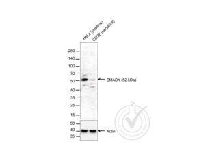 Figure 1. Western blot of lysates from HeLa cells (Lane 1) and c6/36 cells (Lane 2) probed with anti-SMAD1 (upper panel) or with anti-Actin for loading control (lower panel). 