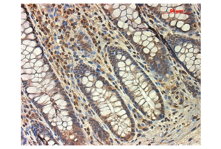 Figure 1. Micrograph image of positive control (human colon tissue) stained with anti-TGF Beta R1 (brown staining). Scale bar = 50 µm.