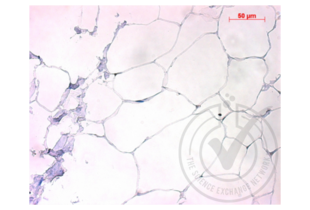 Figure 2. Micrograph image of negative control (human adipose tissue) stained with anti-TGF Beta R1 (brown staining). Scale bar = 50 µm.