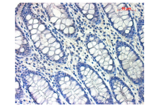 Figure 3. Micrograph image of positive control (human colon tissue) stained with rabbit IgG isotype control antibody (brown staining). Scale bar = 50 µm.