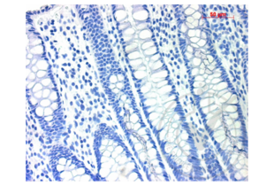 Figure 4. Micrograph image of positive control (human colon tissue) stained with secondary antibody only (brown staining). Scale bar = 50 µm.