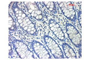 Immunohistochemistry validation image for anti-TGF beta Receptor 1 (AA 301-400) antibody (ABIN671256)