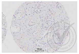 Immunohistochemistry validation image for anti-Tight Junction Protein 1 (TJP1) (AA 1551-1702) antibody (ABIN675024)