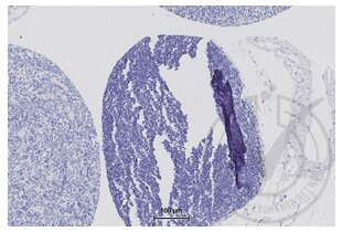 Immunohistochemistry validation image for anti-Tight Junction Protein 1 (TJP1) (AA 1551-1702) antibody (ABIN675024)