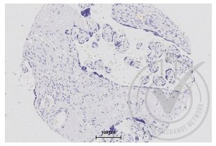 Immunohistochemistry validation image for anti-Tumor Necrosis Factor (Ligand) Superfamily, Member 9 (TNFSF9) (AA 101-200) antibody (ABIN705056)
