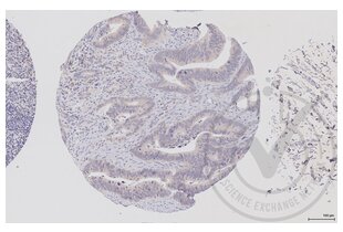 Figure 1: Human colon tissue stained with anti-RAF1 (brown) and counterstained with hematoxylin. 