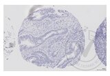 anti-V-Raf-1 Murine Leukemia Viral Oncogene Homolog 1 (RAF1) (AA 31-130) antibody