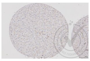 Immunohistochemistry validation image for anti-V-Raf-1 Murine Leukemia Viral Oncogene Homolog 1 (RAF1) (AA 31-130) antibody (ABIN733208)