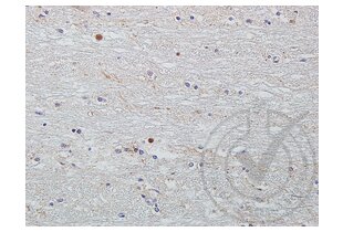 Immunohistochemistry validation image for anti-Wingless-Type MMTV Integration Site Family Member 2 (WNT2) (AA 221-320) antibody (ABIN762896)
